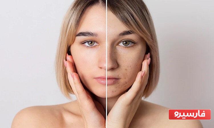 فواید ماسک خانگی منافذ باز پوست و صورت