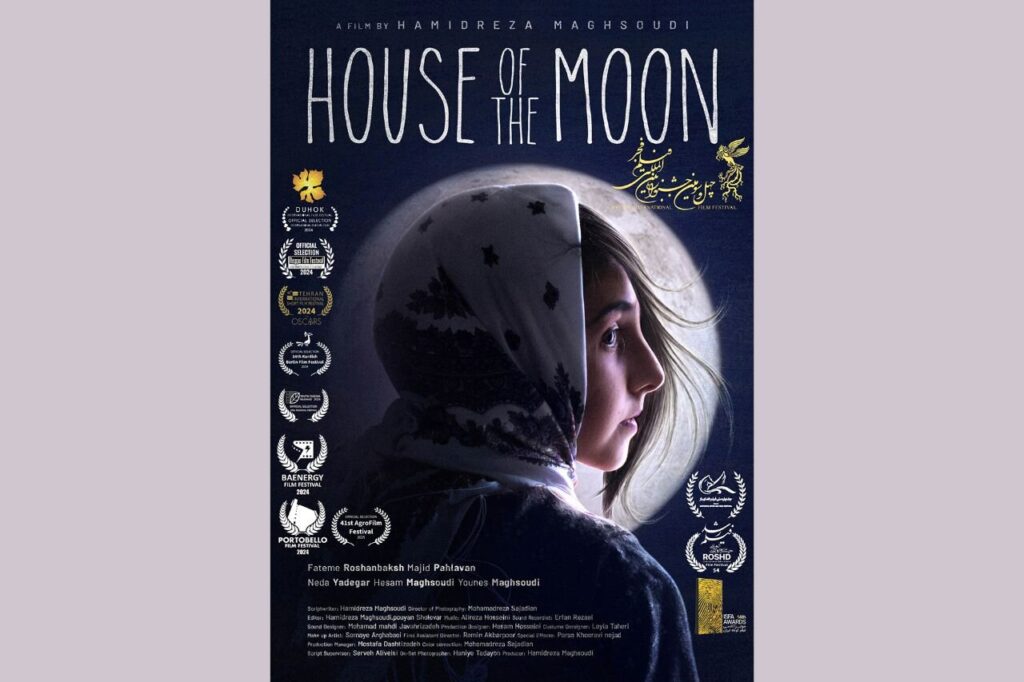 شیلان ، دختری که با نقص مادرزادی روی صورتش متولد شده است