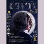 شیلان ، دختری که با نقص مادرزادی روی صورتش متولد شده است