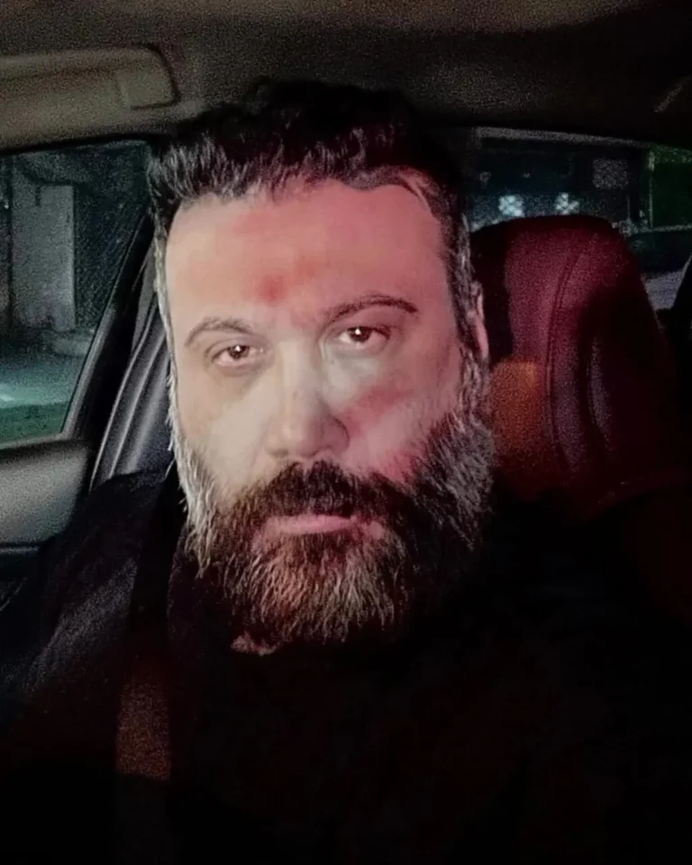 چهره شکسته محسن چاوشی پس از قطعه جدیدش