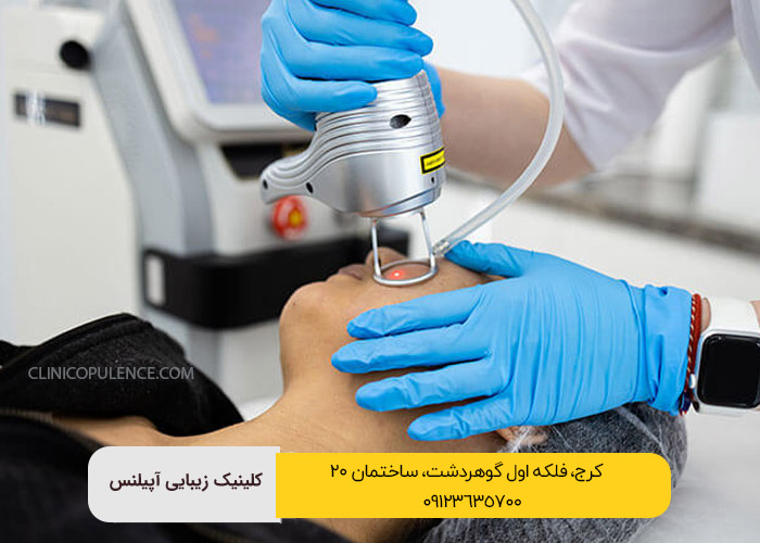 لیزر فرکشنال