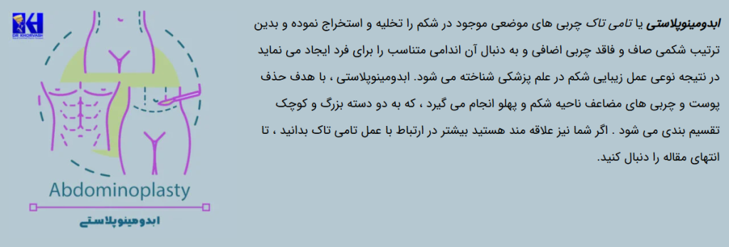 لیست مراقبت های بعد از ابدومینوپلاستی