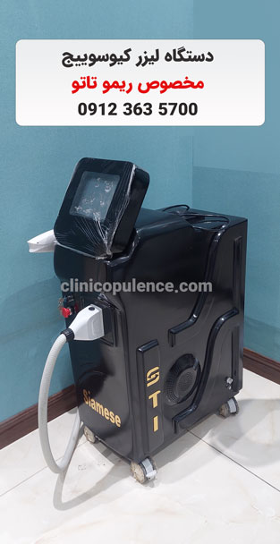 لیزر کیوسوییچ ریمو تاتو