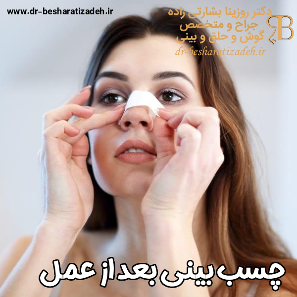 آیا چسب زدن بینی واقعاً باعث زیبایی آن می‌شود؟ راهنمای کامل برای دستیابی به نتیجه ایده‌آل