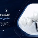 ایمپلنت دندان دائمی است؟ همه چیز درباره طول عمر و ماندگاری آن
